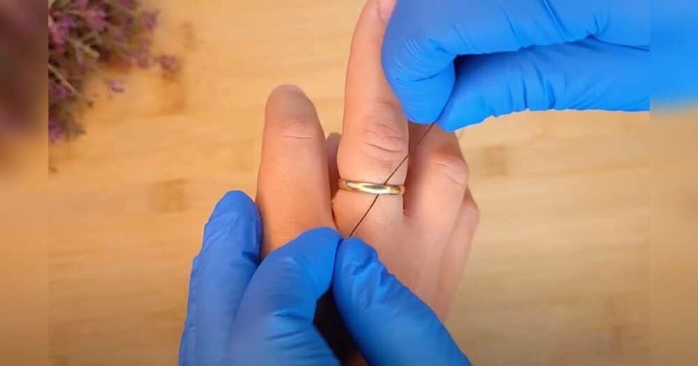 Žena se podělila o jednoduchý trik, který jí ukázal lékař, aby odstranila zaseknutý prsten z prstu